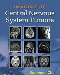 Imaging of Central Nervous System Tumors First Edition