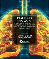 Rare Lung Diseases: A Comprehensive Clinical Guide to Diagnosis and Management First Edition