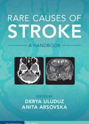 Rare Causes of Stroke: A Handbook