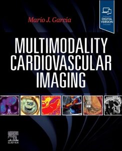 Multimodality Cardiovascular Imaging First Edition