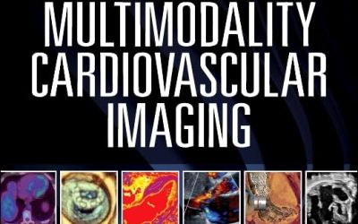 Multimodality Cardiovascular Imaging First Edition