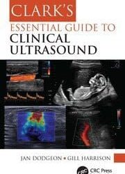 Clark’s Essential Guide to Clinical Ultrasound First Edition