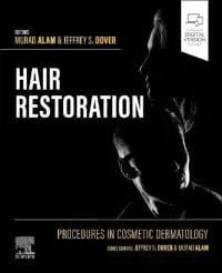 WhatsApp Image 2025-05-13 at 06.53.28 Procedures in Cosmetic Dermatology: Hair Restoration First Edition