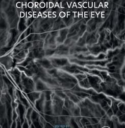 Retinal and Choroidal Vascular Diseases of the Eye First Edition