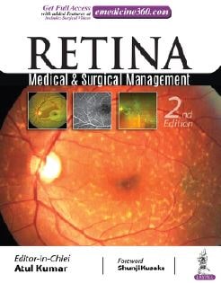 WhatsApp Image 2025-05-13 at 08.52.37 Retina: Medical & Surgical Management Second Edition