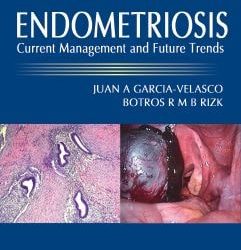Endometriosis: Current Management and Future Trends First Edition