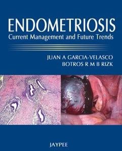 Endometriosis: Current Management and Future Trends First Edition