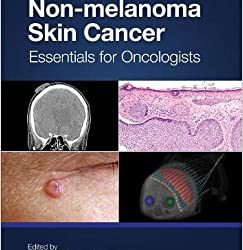 Non-melanoma Skin Cancer: Essentials for Oncologists First Edition