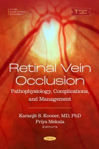 Retinal Vein Occlusion: Pathophysiology, Complications, and Management