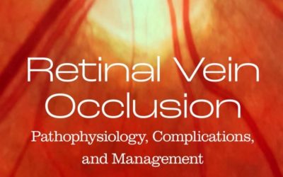 Retinal Vein Occlusion: Pathophysiology, Complications, and Management