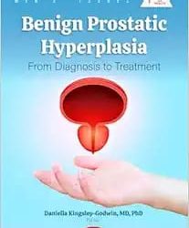 Benign Prostatic Hyperplasia: From Diagnosis to Treatment