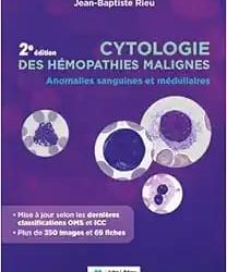Cytologie des Hémopathies Malignes: Anomalies Sanguines et Médullaires