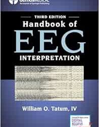 Handbook of EEG Interpretation, Third Edition – A Comprehensive EEG Book for Neurology Residents and Fellows, Clinicians, and Technologists Third Edition