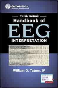 Handbook of EEG Interpretation, Third Edition – A Comprehensive EEG Book for Neurology Residents and Fellows, Clinicians, and Technologists Third Edition