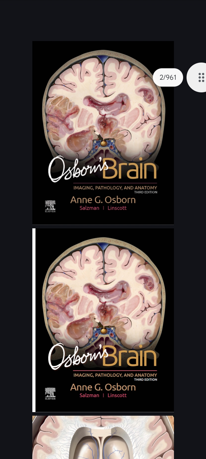 Osborn's Brain Imaging Pathology And Anatomy 3rd Edition pdf Osborn’s Brain Imaging Pathology And Anatomy Third Edition