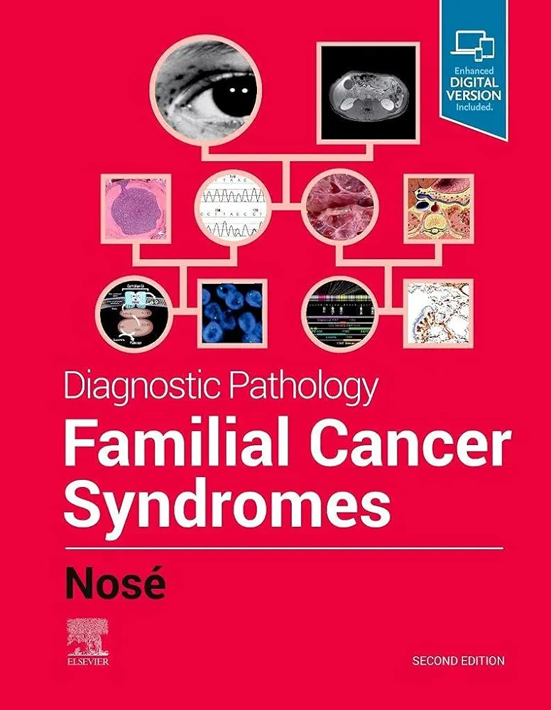 61dJe7AnWNS._UF1000,1000_QL80_FMwebp_ Diagnostic Pathology: Familial Cancer Syndromes 2nd Edition