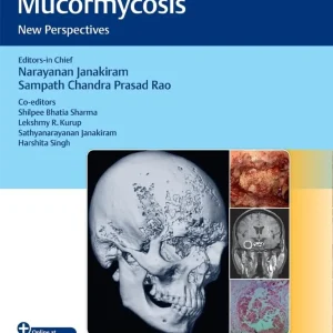 Invasive Skull Base Mucormycosis: New Perspectives First Edition