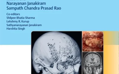 Invasive Skull Base Mucormycosis: New Perspectives First Edition