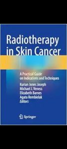 Radiotherapy in Skin Cancer: A Practical Guide on Indications and Techniques