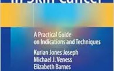 Radiotherapy in Skin Cancer: A Practical Guide on Indications and Techniques