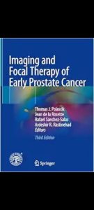 Imaging and Focal Therapy of Early Prostate Cancer Second Edition