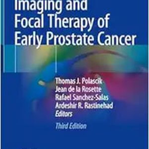 Imaging and Focal Therapy of Early Prostate Cancer Second Edition