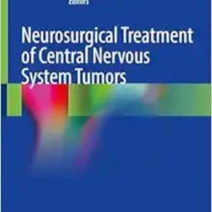 Neurosurgical Treatment of Central Nervous System Tumors 2024 Edition