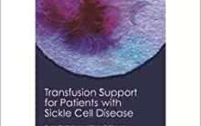 Transfusion Support For Patients With Sickle Cell Disease Second  Edition