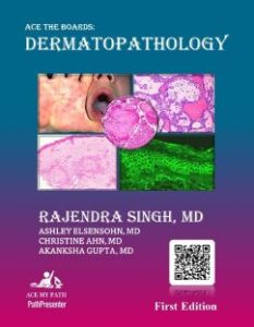 Ace The Boards Dermatopathology (Ace My Path)