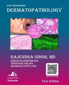 Ace The Boards Dermatopathology (Ace My Path)