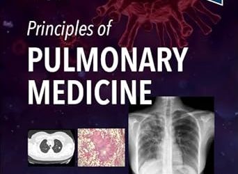 Principles of Pulmonary Medicine, 8th Edition