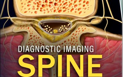 Diagnostic Imaging: Spine, 5th Edition