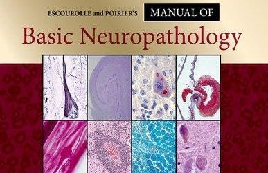Escourolle and Poirier’s Manual of Basic Neuropathology 7th Edition