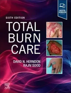 Total Burn Care, 6th Edition