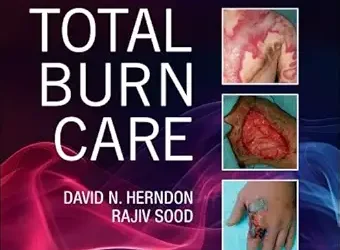 Total Burn Care, 6th Edition