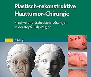 Plastisch-rekonstruktive Hauttumor-Chirurgie: Kreative und ästhetische Lösungen in der Kopf-Hals-Region (MONOGRAPHIE – Fachbuch – Urban & Fischer-Verlag), 2nd Edition