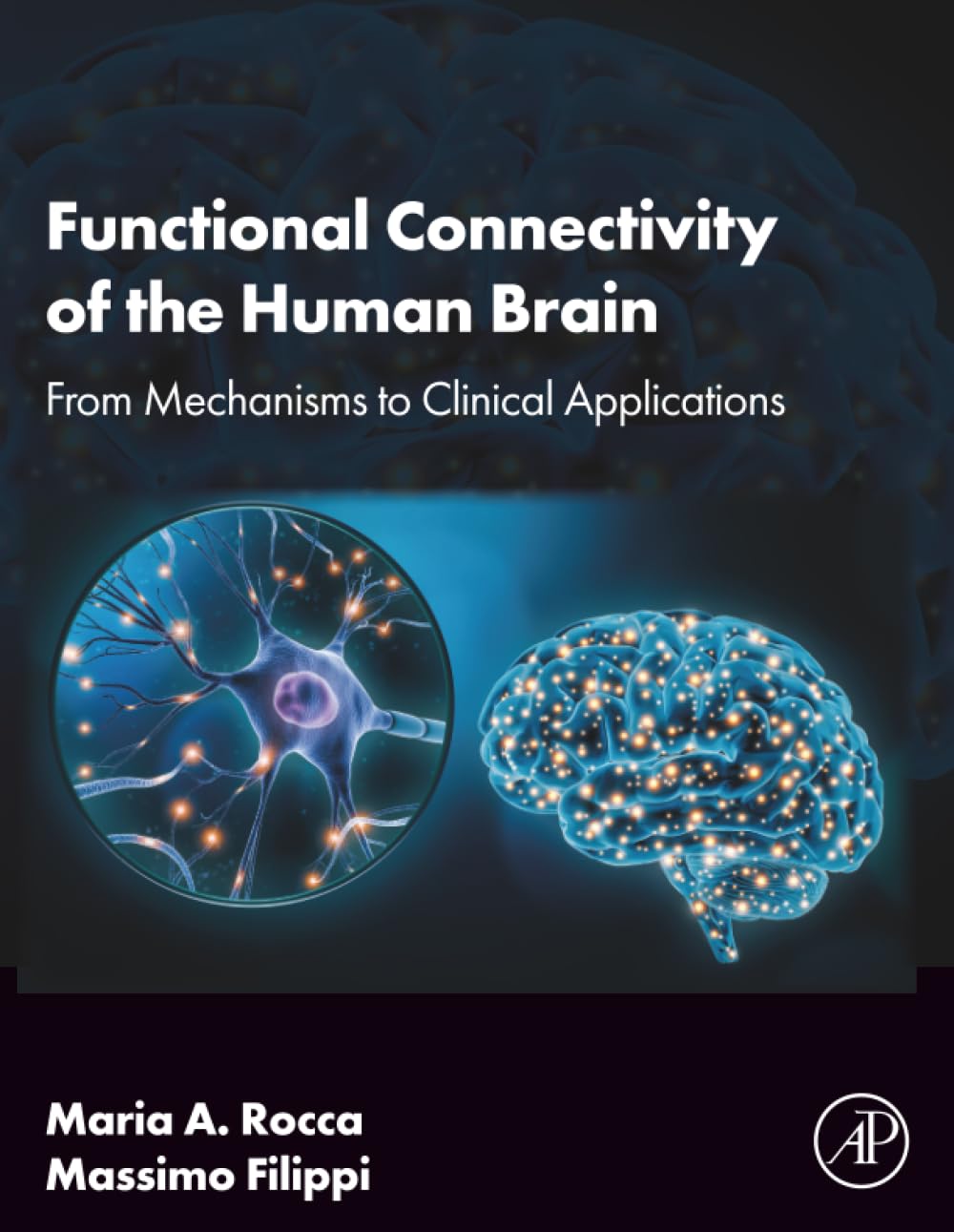9780443190995 Functional Connectivity of the Human Brain: From Mechanisms to Clinical Applications 1st Edition