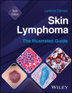 Skin Lymphoma The Illustrated Guide 6th Edition