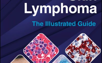 Skin Lymphoma The Illustrated Guide 6th Edition