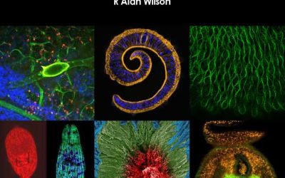 The Cell Biology of Schistosomes: Implications for Diagnostics and Vaccines