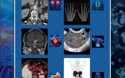 A Practical Handbook of Endocrine Imaging