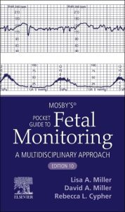 Mosby’s® Pocket Guide to Fetal Monitoring (Nursing Pocket Guides), 10th edition