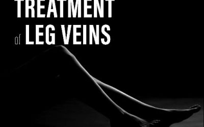 Procedures in Cosmetic Dermatology Series: Treatment of Leg Veins, 3rd edition