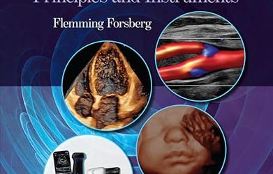 Kremkau’s Sonography Principles and Instruments, 11th edition
