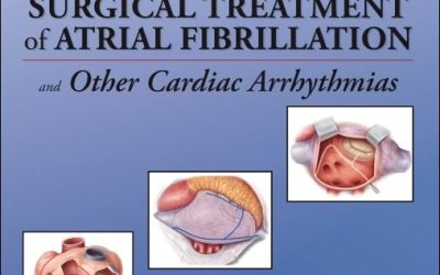Cox’s Surgical Treatment of Atrial Fibrillation