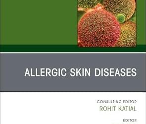 Allergic Skin Diseases, An Issue of Immunology and Allergy Clinics of North America (Volume 45-4)