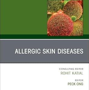 Allergic Skin Diseases, An Issue of Immunology and Allergy Clinics of North America (Volume 45-4)