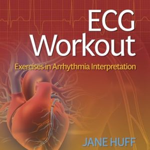 ECG Workout: Exercises in Arrhythmia Interpretation, 8th edition
