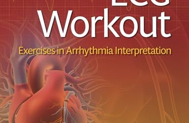 ECG Workout: Exercises in Arrhythmia Interpretation, 8th edition
