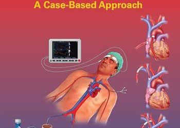 Clinical ECMO Management: A Case-Based Approach